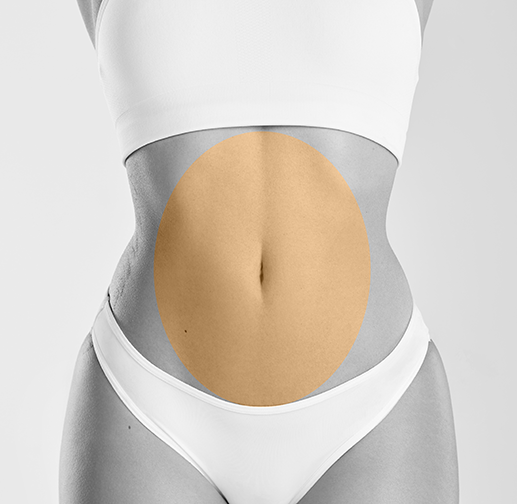Epilare cu laser abdomen
