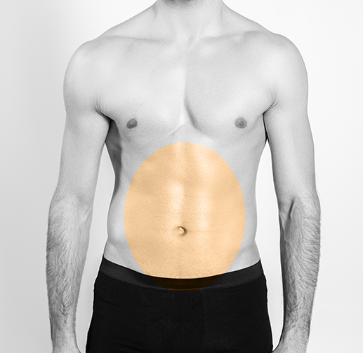 Epilare cu laser abdomen