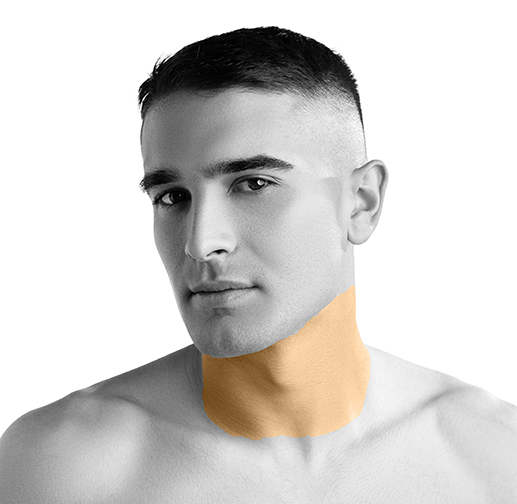 Epilare cu laser gât