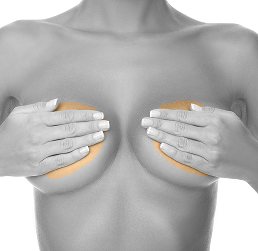 Epilare cu laser periareolar
