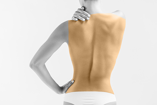 Epilare cu laser spate